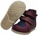 Купити Ортопедичні черевики для дівчинки антиварусні Ortop 205VB (AV) з доставкою додому в інтернет-магазині ортопедичних товарів і медтехніки Ортоп